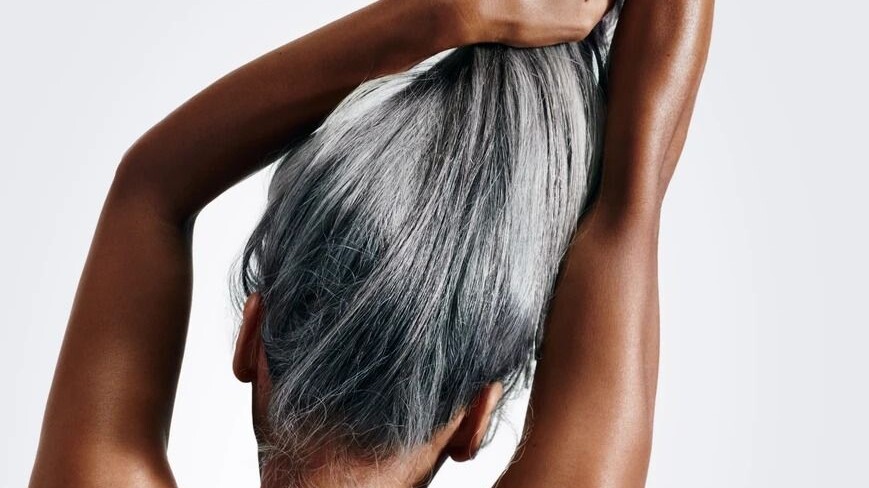 perte de cheveux femme 70 ans